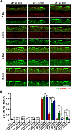 《Science Adv.》可注射光敏水凝胶,金属组装递送神经保护蛋白的图7